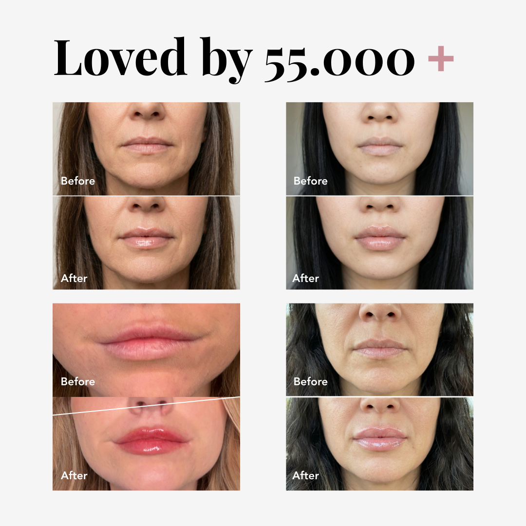 COSTIQ® EXTREME LIP PLUMPER